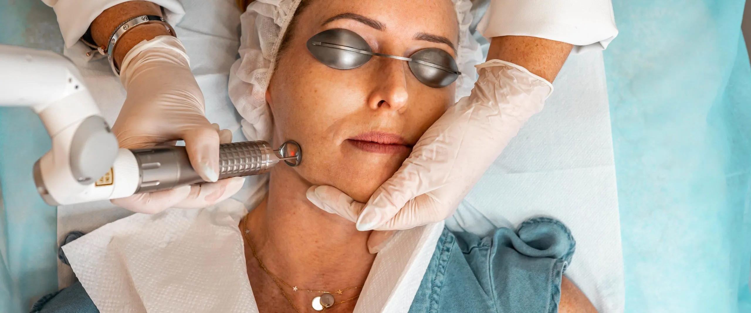 How To Care For Your Skin After Laser Treatments